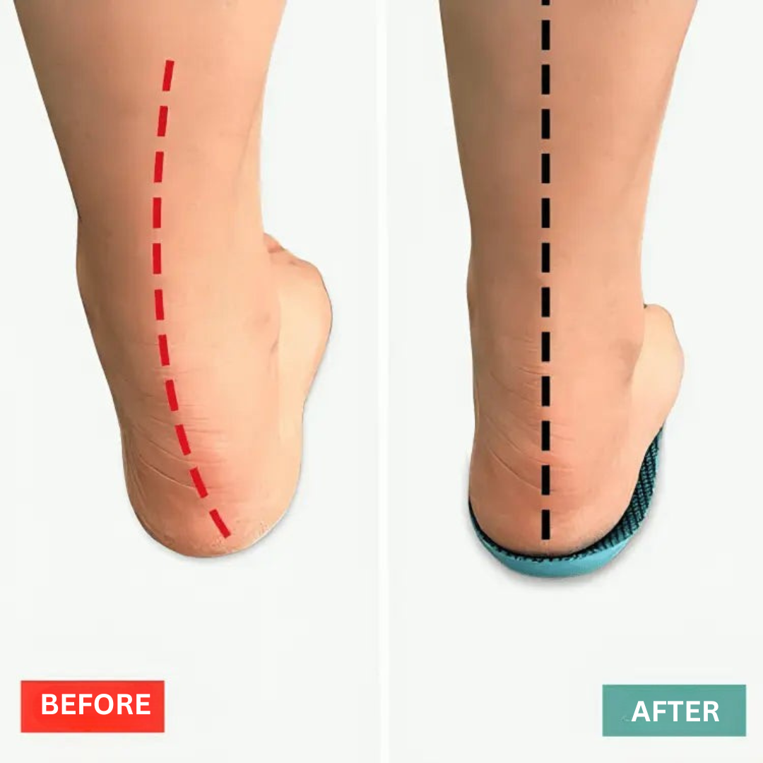 Shoe Insoles with Gel Support for Comfort